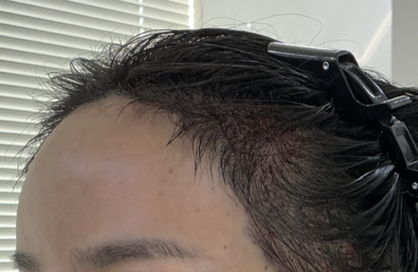 after
